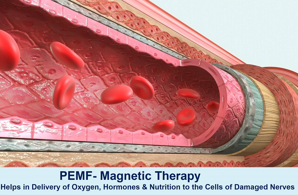 PEMF-Magnet therapy helps in the delivery of nutrients & oxygen to the damaged nerves & reverses the peripheral neuropathy