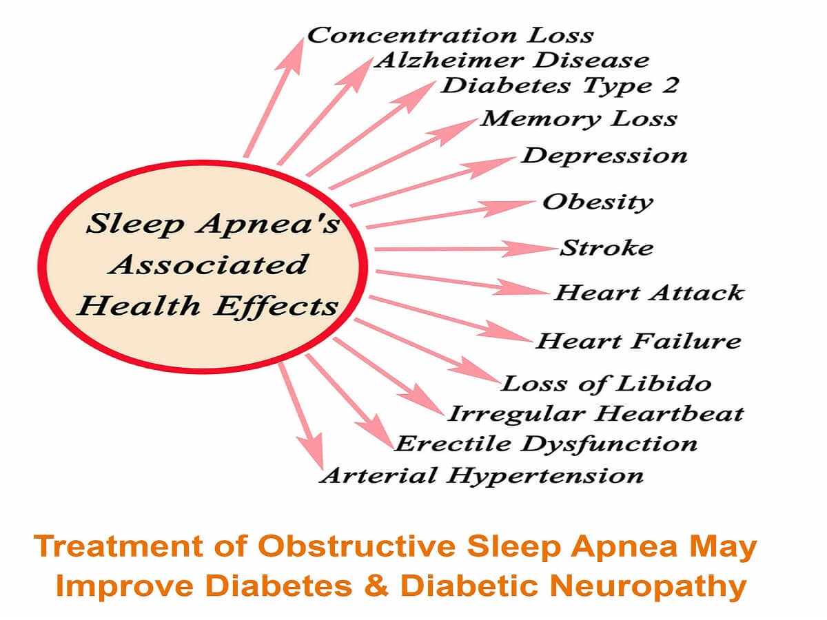 Obstructive sleep apnea can cause neuropathy, sexual dysfunction, obesity, stroke, heart failure, diabetes, depression, etc.
