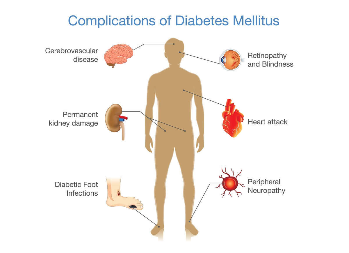 Diabetic causes damage to the kidney, heart, eyes, hands, feet, and sexual organs & is the root cause of diabetic neuropathy.