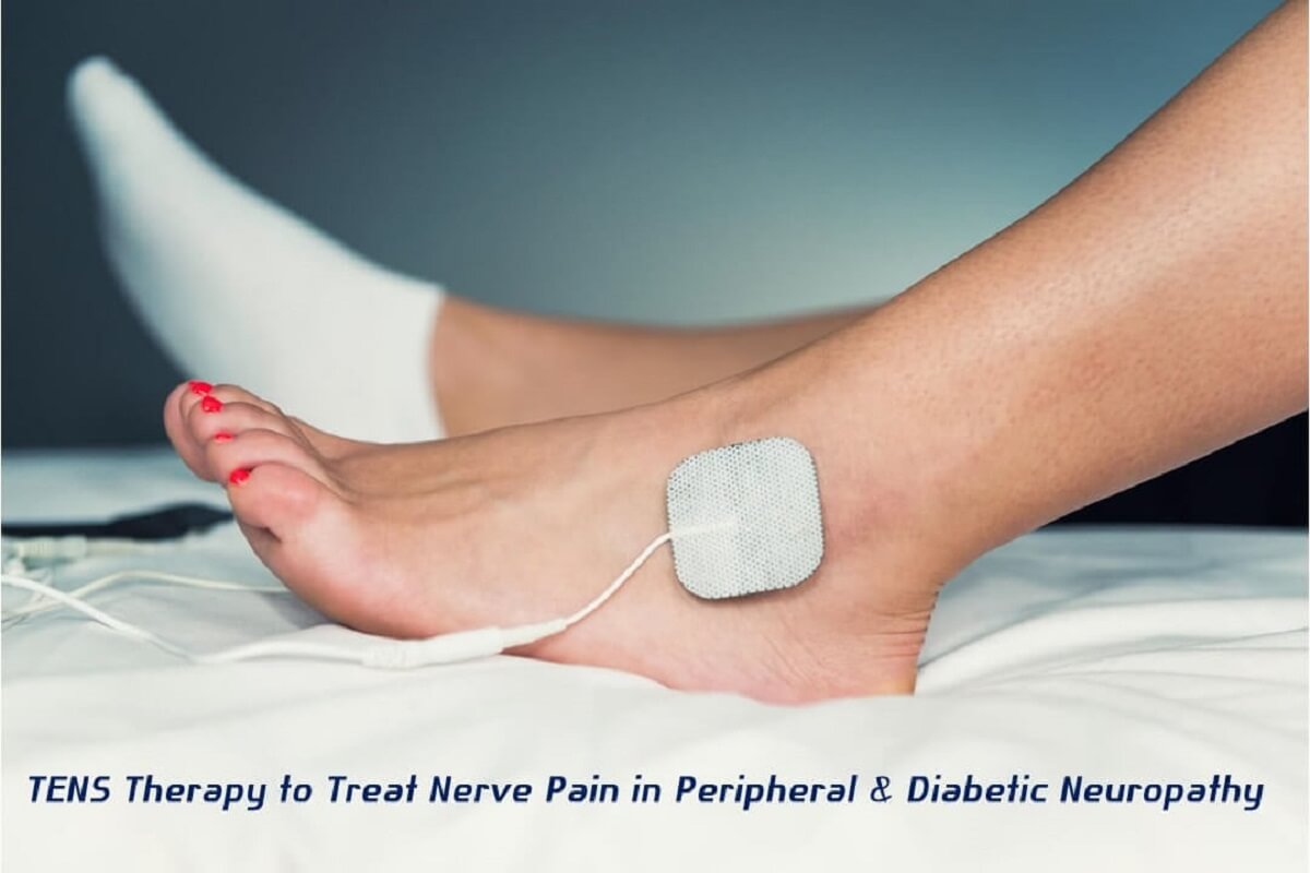 TENS therapy for peripheral & diabetic neuropathy is a safe non-invasive, drug-free, scientific method of nerve pain relief.
